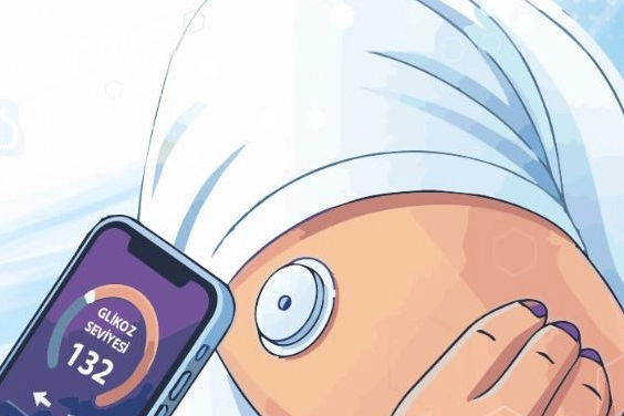 Bursa'da diyabetli üniversite öğrencilerine yönelik şeker sensörü destek programı