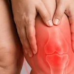 Lipödemin diz eklemleri üzerindeki etkileri ve kireçlenmeye yol açması