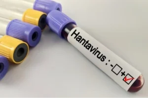 Kapalı alan temizliği sırasında hantavirüs riskine karşı uyarılar